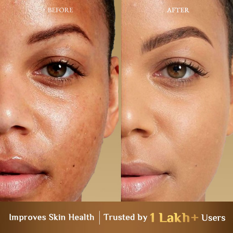 download - 2025-04-01T171957.236